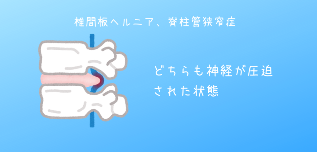 椎骨と椎間板の説明