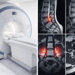 坐骨神経痛フォローアップMRI検査 ― 画像と経過の関係 ―