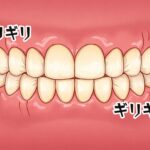 歯の食いしばりと痛み