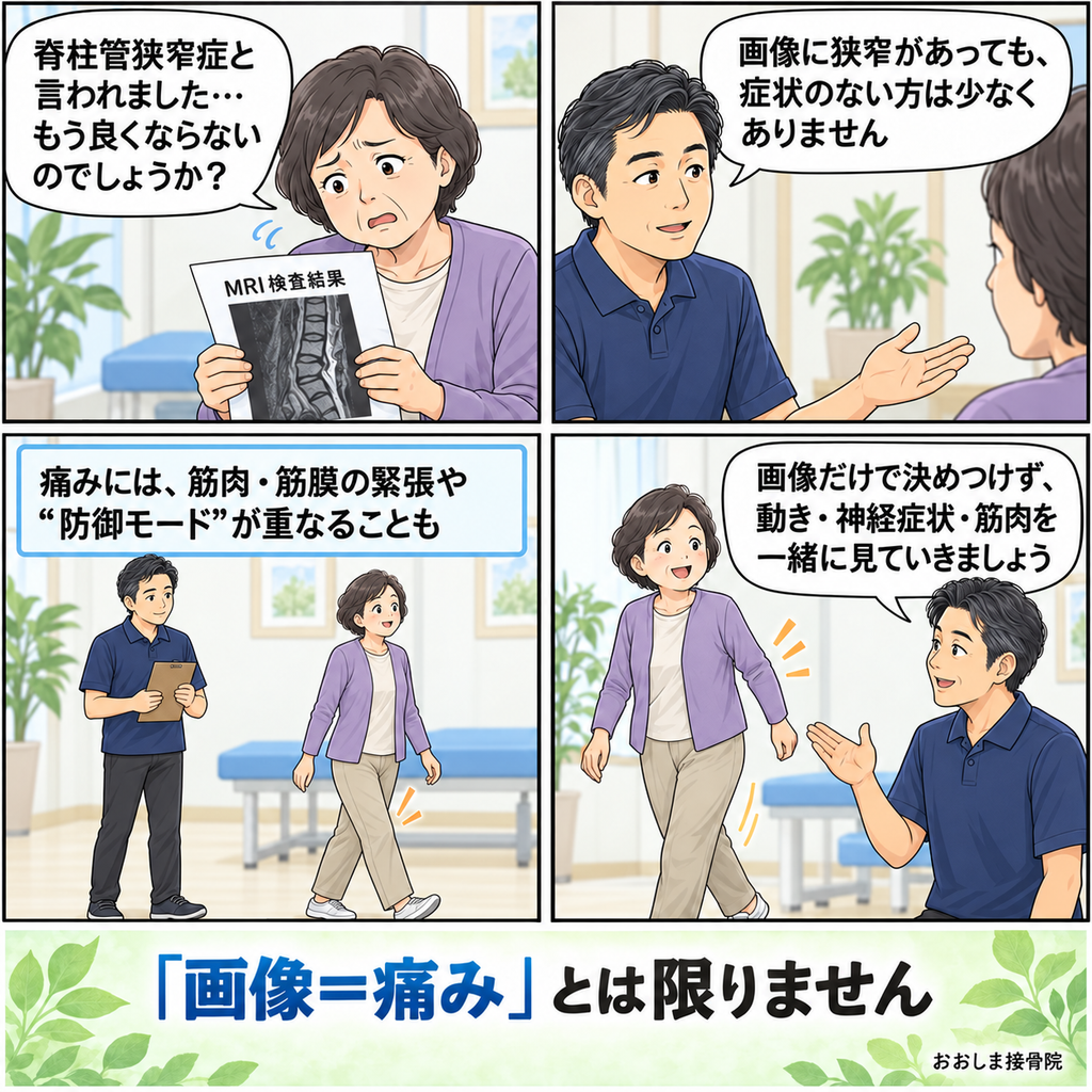 脊柱管狭窄症と言われ不安を抱く女性に、画像所見だけで痛みを決めつけず、筋肉や身体の動きも確認する大切さを伝える4コマ漫画