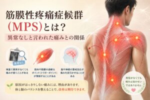 筋膜性疼痛症候群（MPS）とは？異常なしと言われた痛みとの関係