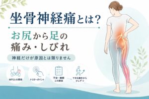 坐骨神経痛とは？お尻から足の痛み・しびれと筋膜性疼痛症候群（MPS）｜蓮田市のおおしま接骨院