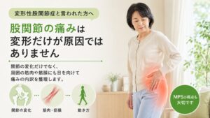 変形性股関節症と言われたのに痛みが続く理由｜筋膜性疼痛症候群（MPS）が関係する股関節痛