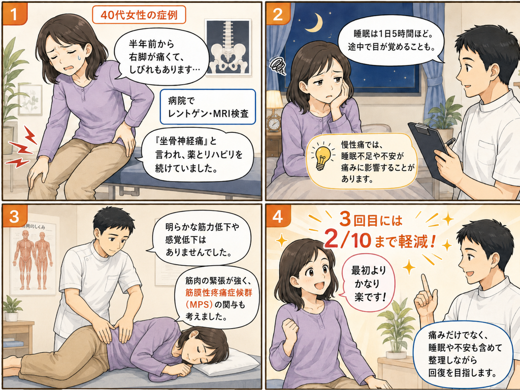 坐骨神経痛と言われた40代女性の症例を4コマで紹介。半年続く右脚の痛み・しびれ、睡眠不足、筋肉の緊張やMPSの関与を確認し、3回目には初回の2/10程度まで楽になった経過を示した漫画