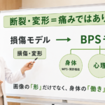 画像に損傷や変形がある＝痛みの原因？「損傷モデル」からBPSモデルへ
