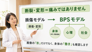 画像に損傷や変形がある＝痛みの原因？「損傷モデル」からBPSモデルへ