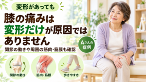 膝の変形が痛みの原因とは限りません―右膝痛で歩けなかった60代女性の症例